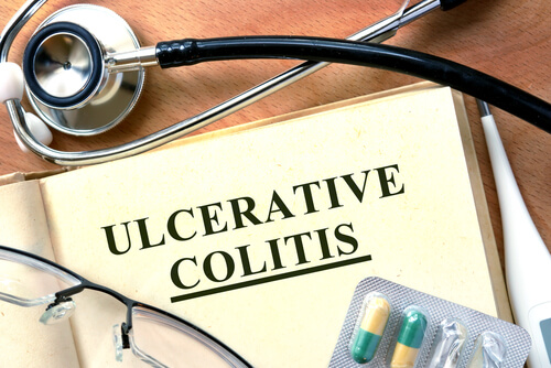Understanding Ulcerative Colitis VA Rating